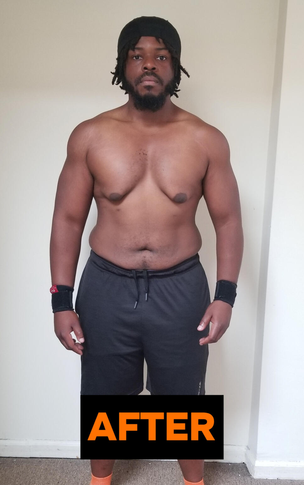 Marc A after transformation