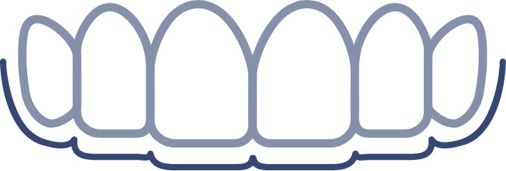 Line drawing of upper teeth wearing a clear Invisalign aligner