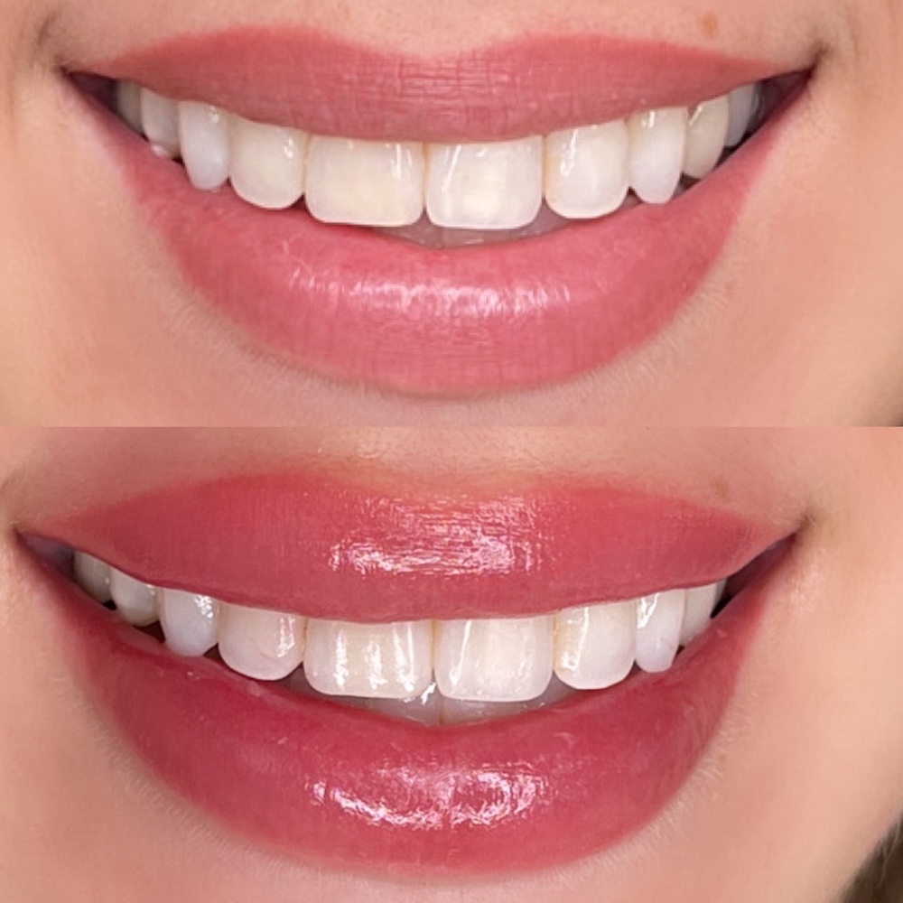 Before and after lip blush tattoo, close-up smile