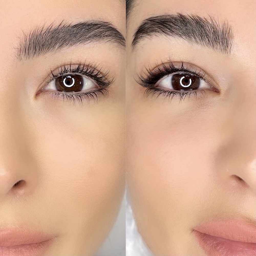 Before and after permanent eyeliner, split close-up of a client's eyes