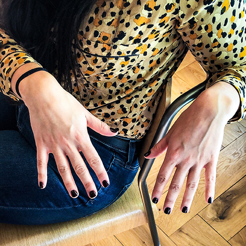 Woman in a leopard-print blouse showing a dark manicure on her lap