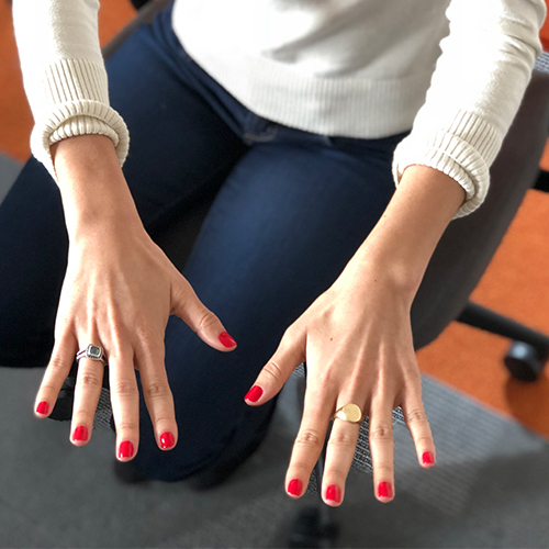 Woman in a white top showing both hands with red manicure on her knees