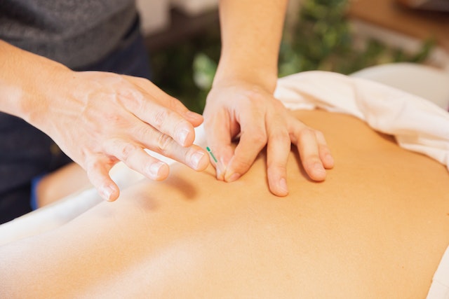 Acupuncture needles being inserted into a patient's back
