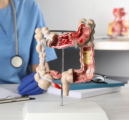 Anatomical model of the colon and large intestine on a stand