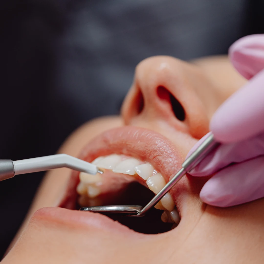 Dental examination with mirror and probe — emergency dentistry