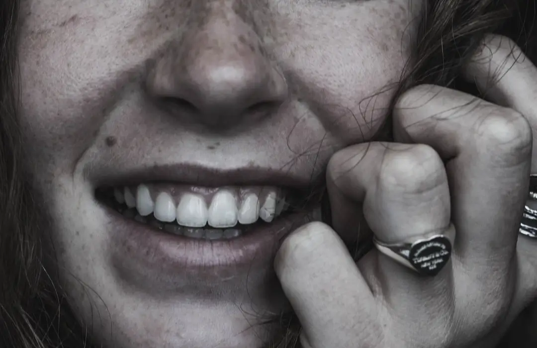 Person touching their face near a chipped tooth