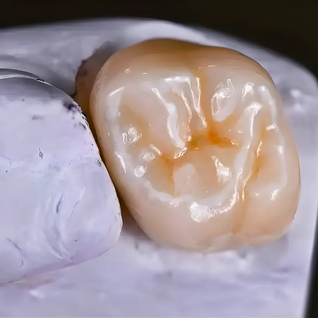 Ceramic dental crown close-up — general dentistry