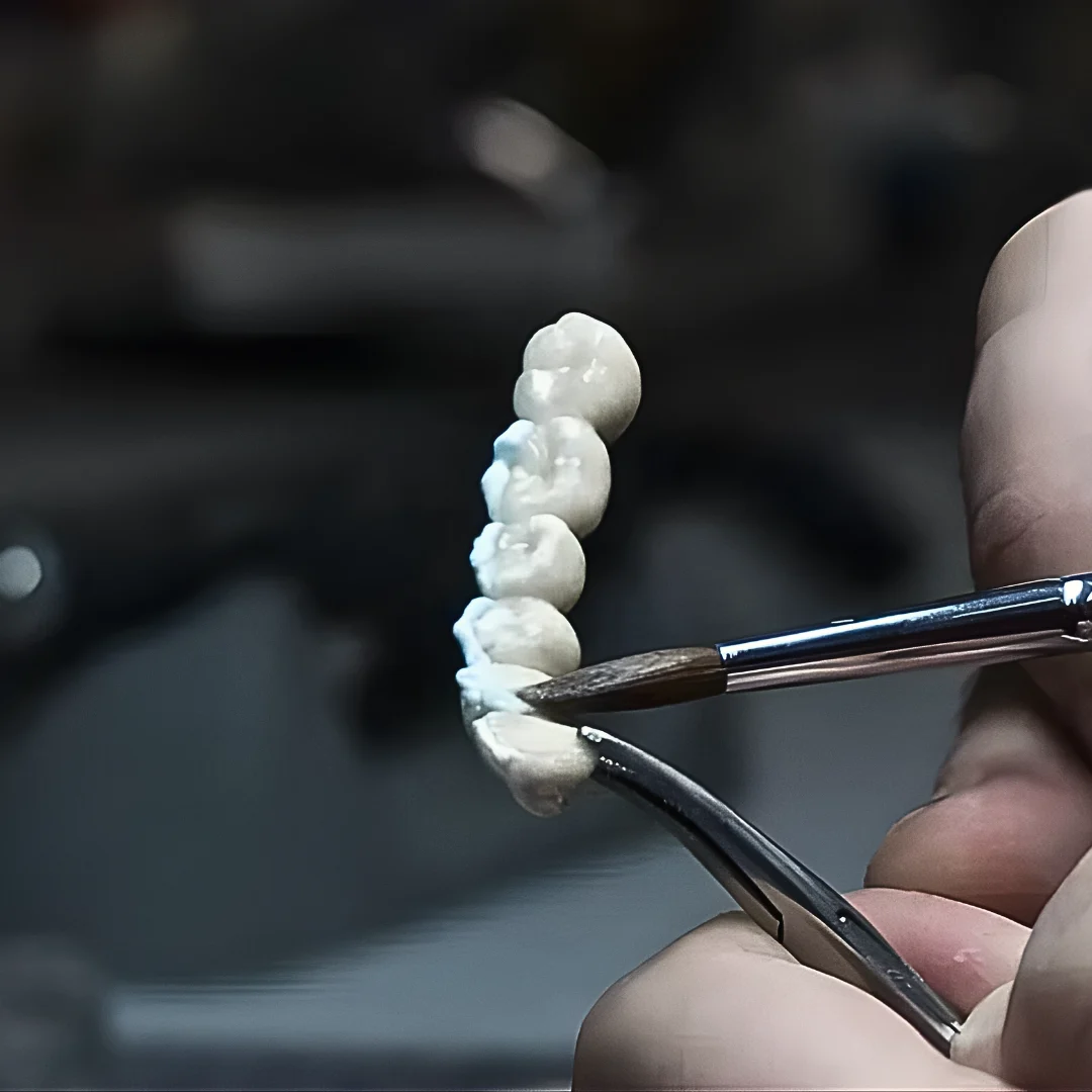 Dental technician finishing a ceramic bridge — restorative dentistry